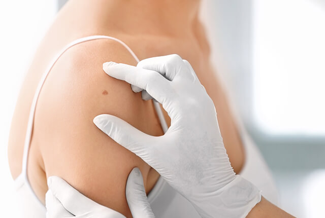 肩のできものを診察している様子