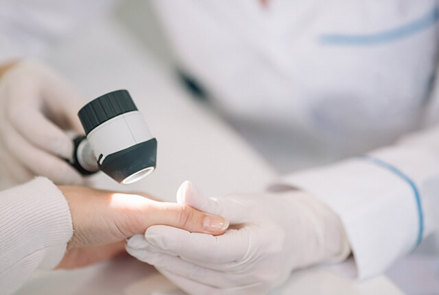 手の甲をダーモスコープで診察している様子